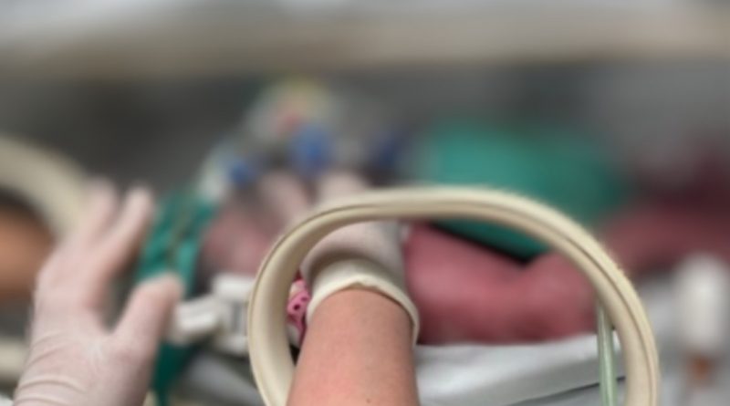 Nacen siamesas en el Hospital Regional Materno Infantil de NL